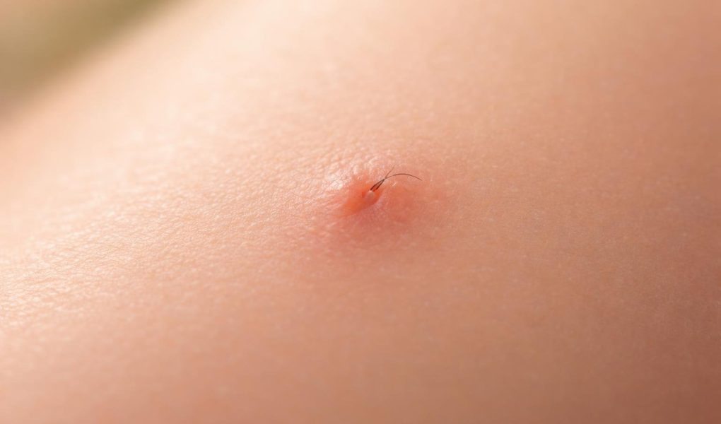 peau-lisse-poil-incarne-flou-naturel