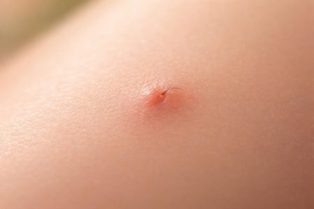 peau-lisse-poil-incarne-flou-naturel